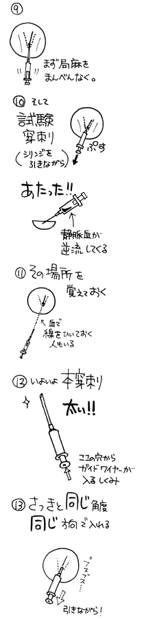 挿入 介助 Cv Cv 挿入