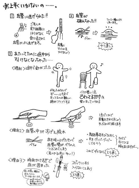 ねじ子web 完璧手技第5回 採血